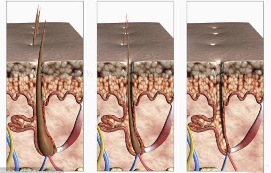 沙宣“退位让贤”,护发届翘楚“阿玛尼”上线,网友:良心洗发水