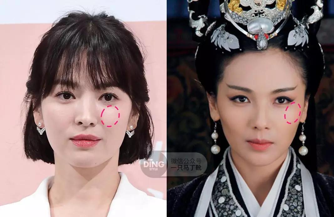 颧弓高脸型怎么改善,有泪沟可以通过调整脸型改善嘛