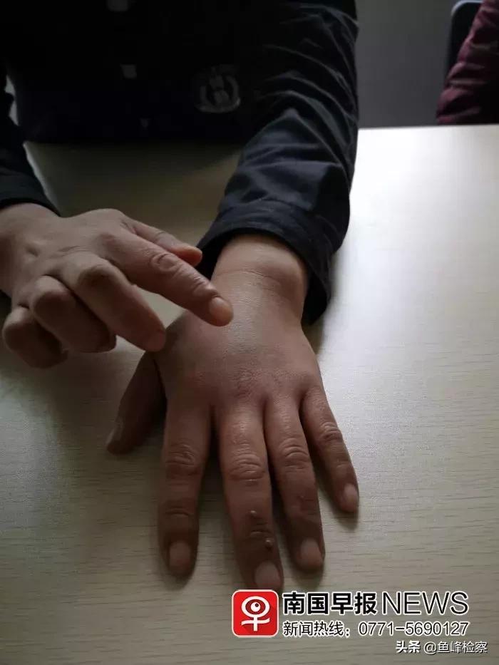 南宁宁铁馨苑小区暗藏六七十家“黑旅馆”！保安查岗遭暴打：“再拦搞死你”