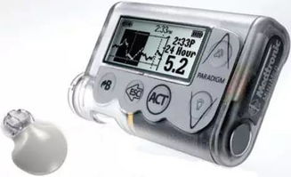 胰岛素泵科普；降伏糖魔的绝招是什么？这4点好处让糖友又爱又恨