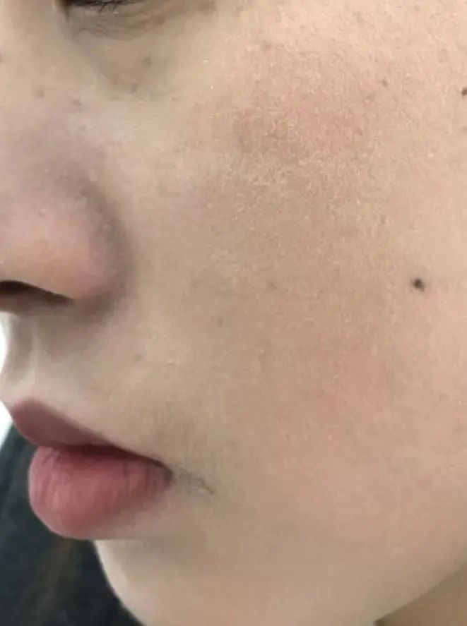 护肤达人分享经验,15年护肤达人分享