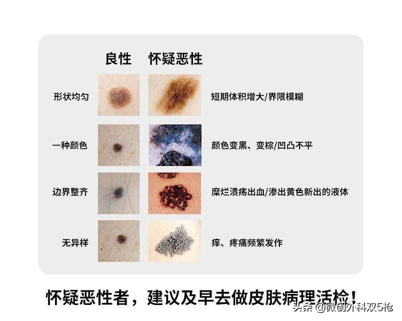 女大学生抗癌7年摆摊卖花救母,女大学生抗癌7年卖花