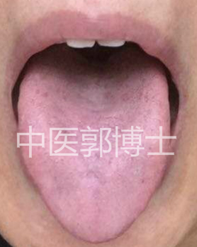 咳嗽咳出褐色石头,咳吐白色粘痰吃什么药