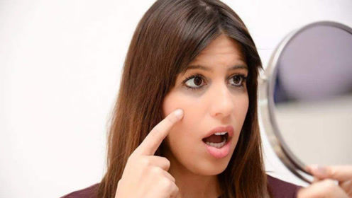 熬夜容易有熊猫眼如何消除黑眼圈,熊猫眼黑眼圈治疗偏方