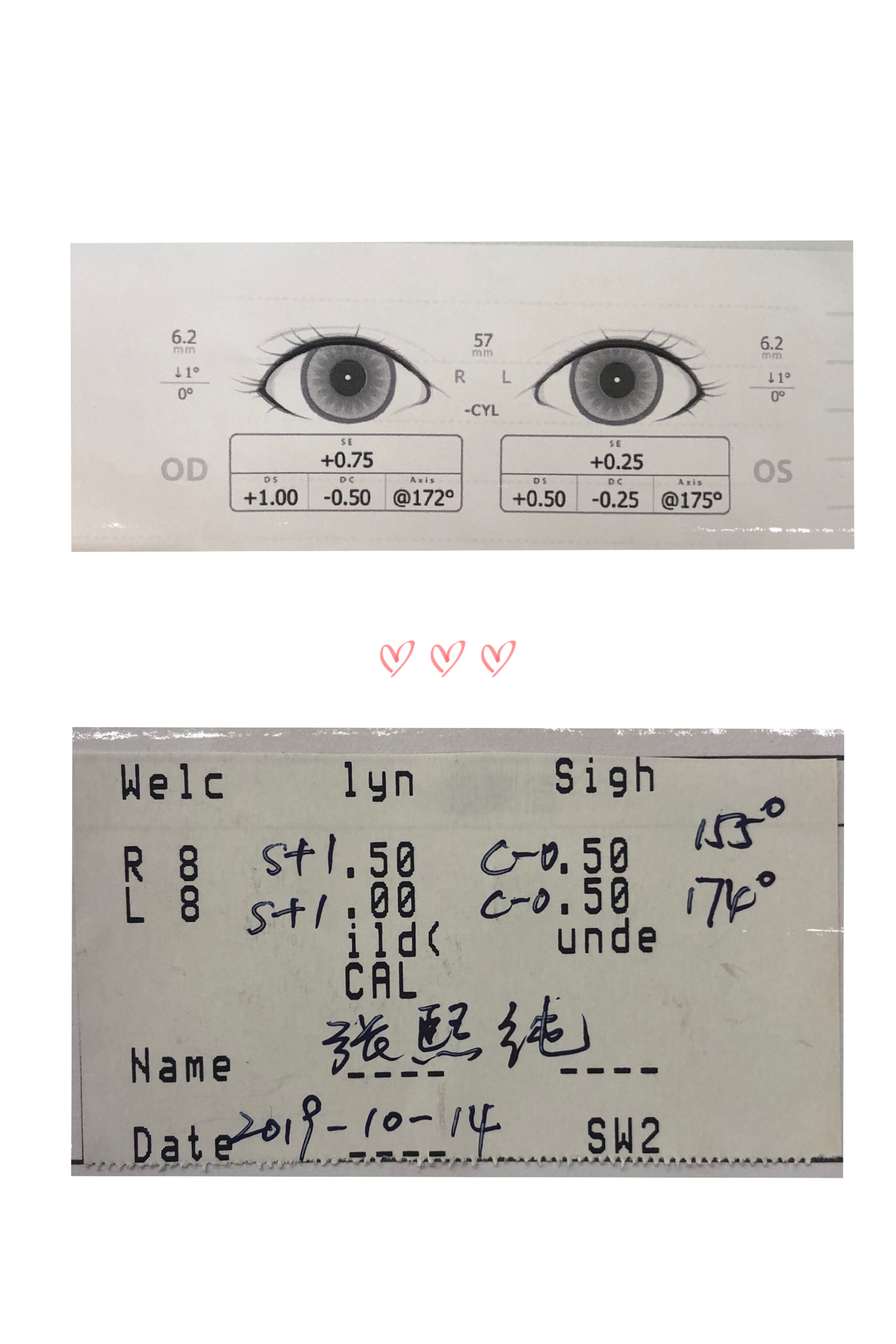 如何看懂眼科儿童验光单,怎么看懂视力验光单子