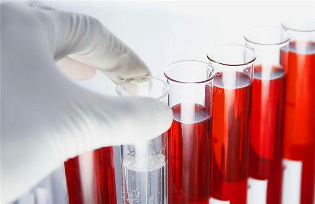 非洲一只黑猩猩,是怎么把艾滋病传给非洲黑人,再传到全世界的?