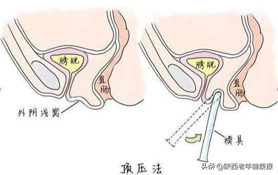 「硬核技术」男友为25岁“石女”寻医