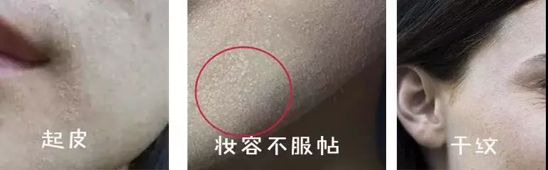 国货修护祛痘印护肤品推荐,堪比大牌平价护肤品