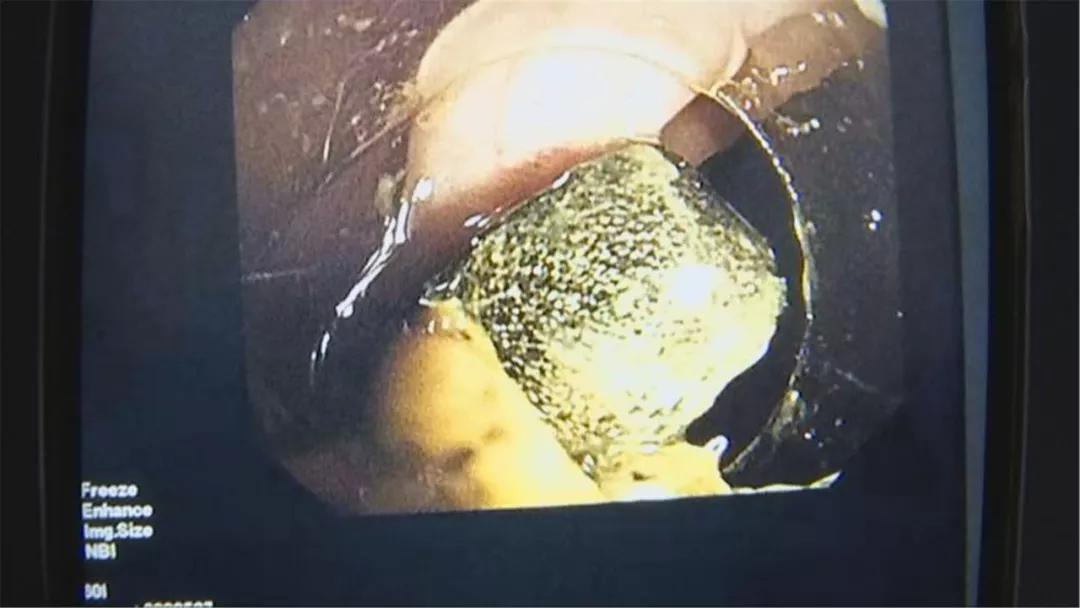 4岁男孩吃了它，体内充血水肿糜烂！快把家中这个东*藏西**好