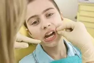 多图直击！牙医如何用抛光把孩子的牙洗干净？#葉子口腔科普#