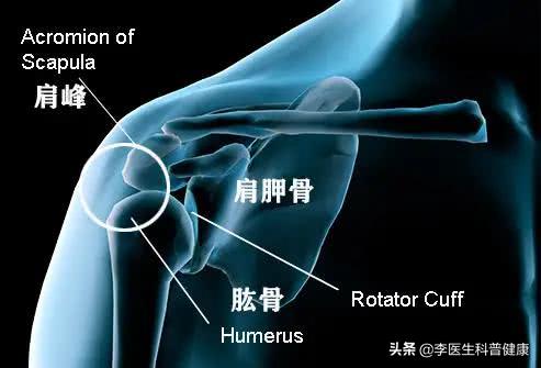你有肩颈痛的症状吗,肩膀疼的原因和解决方法