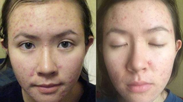 完美芦荟胶和别的芦荟胶的区别,自然乐园芦荟胶和完美哪个更祛痘