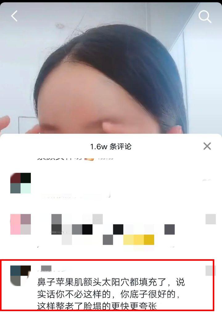 娄艺潇填充脂肪前后对比,娄艺潇填充前后对比