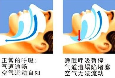 唐山市协和医院义诊,协和医院睡眠健康义诊活动