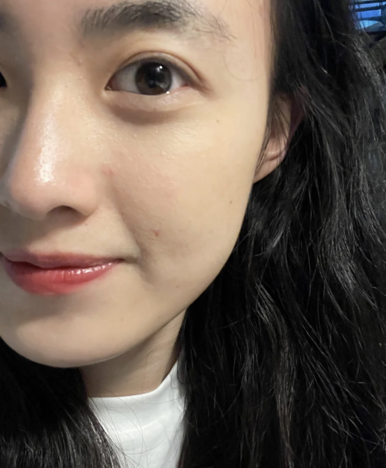 眼尾有皱纹怎么治疗,眼尾沟里面有皱纹怎么办