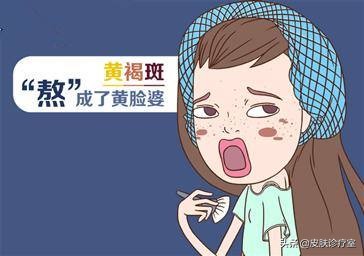 褐斑有什么症状,褐斑的症状及治疗方法