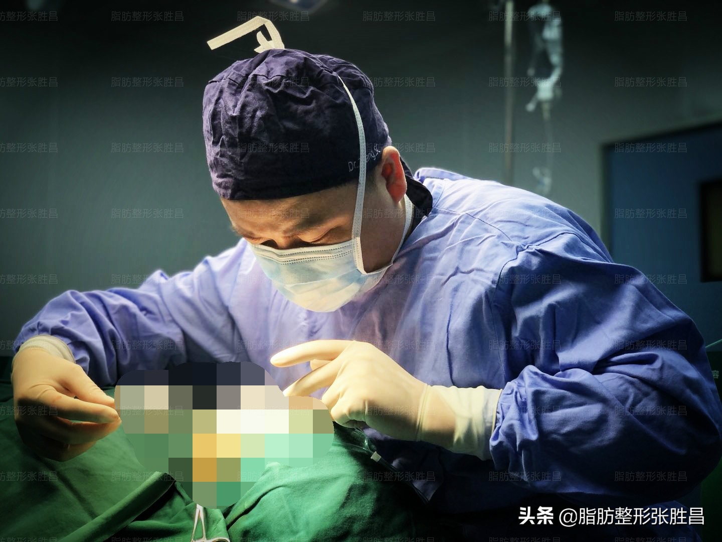 为何面部吸脂会失败？这种整容失败还有得救吗？今日医生揭开谜底