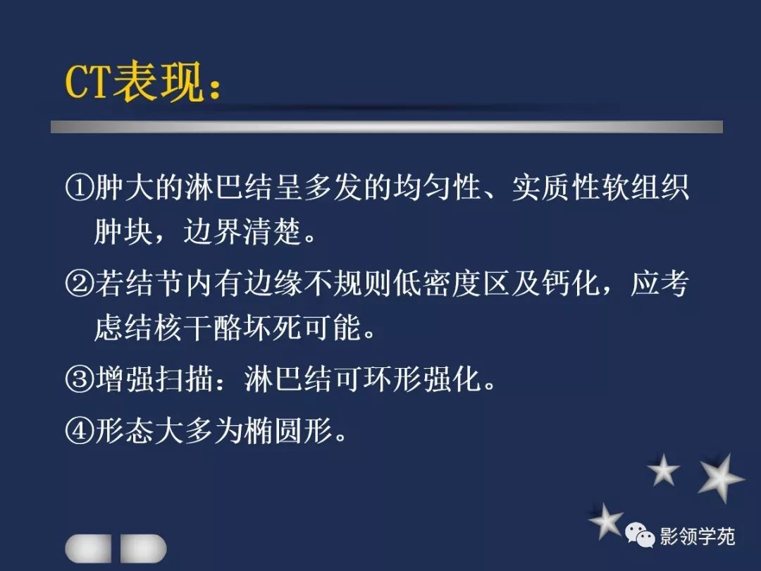 腮腺疾病影像学诊断,腮腺肿块影像诊断