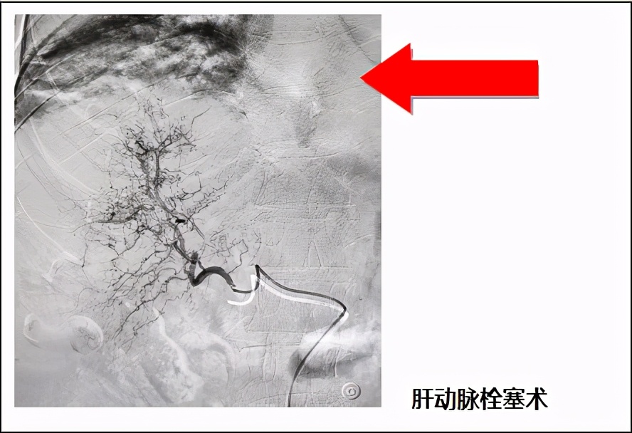 临夏州医院普通内科专家,临夏县人民医院