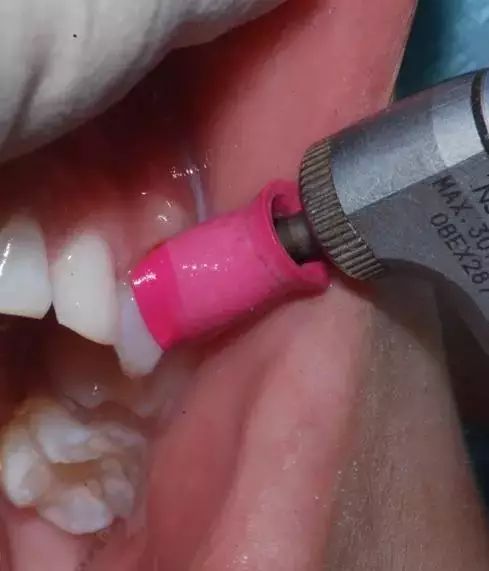 孩子嘴里味道很怪,儿童嘴里有消化不良的味道