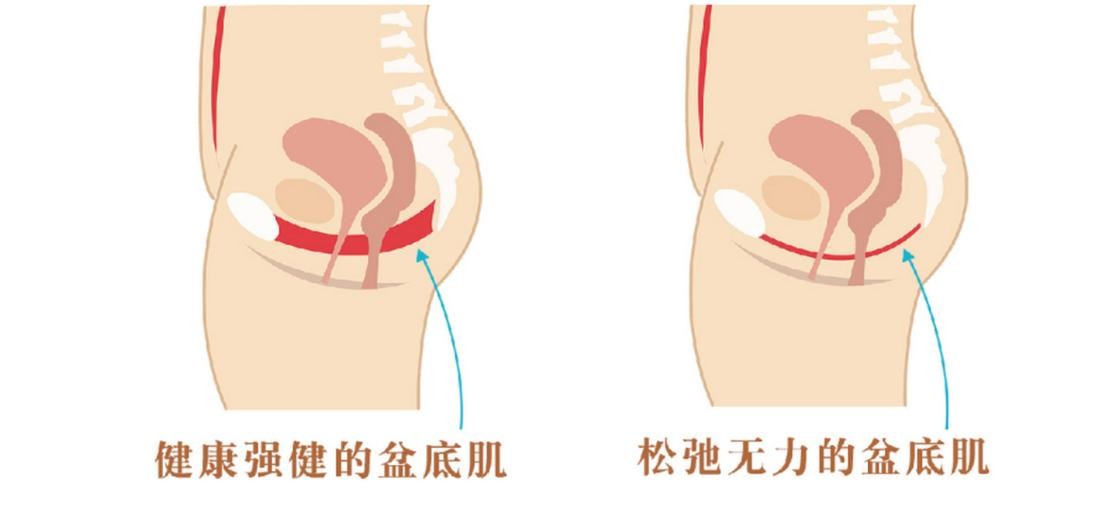 关于女性分娩话题,评论女人生娃前后的变化