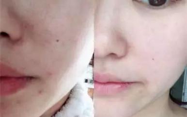 火山泥真是宝，油皮女孩的毛孔疏通剂，让贵妇霜3秒吃透锁水8倍