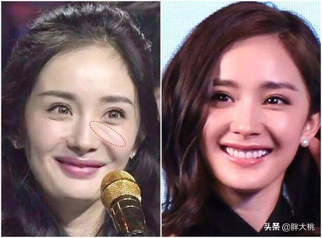 美容店按摩脸部可以淡化法令纹吗,按摩筋膜法令纹可以淡化吗