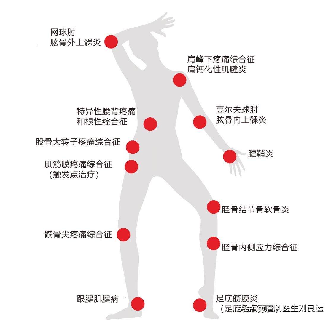 脚痛不知道是不是痛风,脚很痛不知道是痛风还是脚筋痛