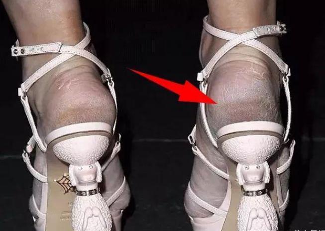 郑恺李佳琦,郑恺同款贴纸