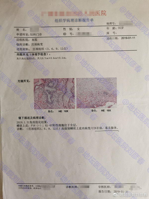 女，35岁，CIN2级，姑娘们，还以为宫颈癌离你们很远吗？