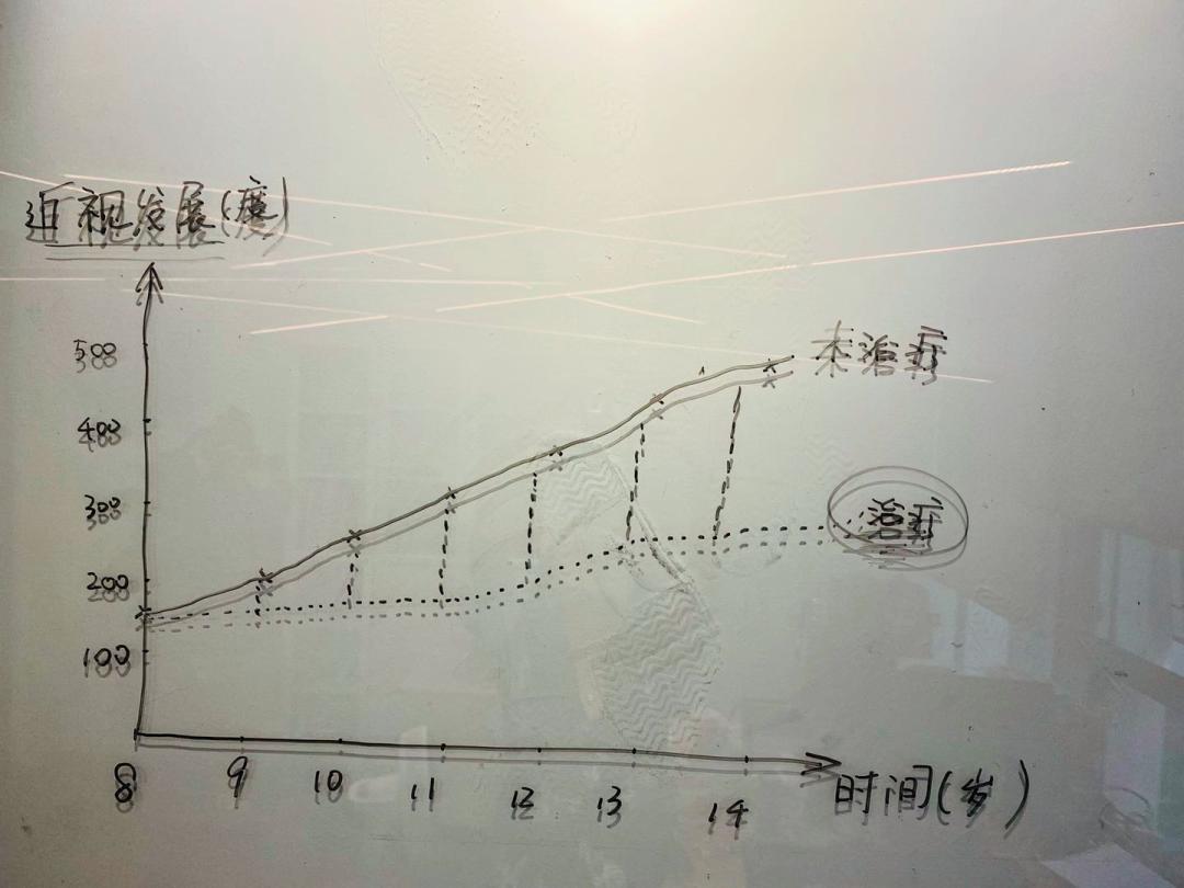 我的天!8岁暖暖竟然150度真性近视了