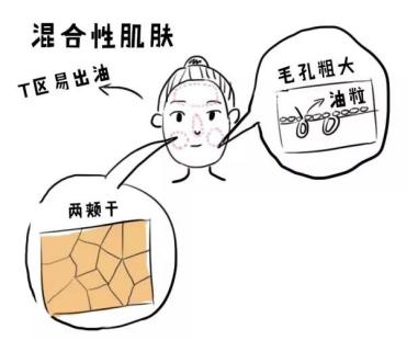 冬天爆干、夏天油泵，混油皮到底该肿么办？