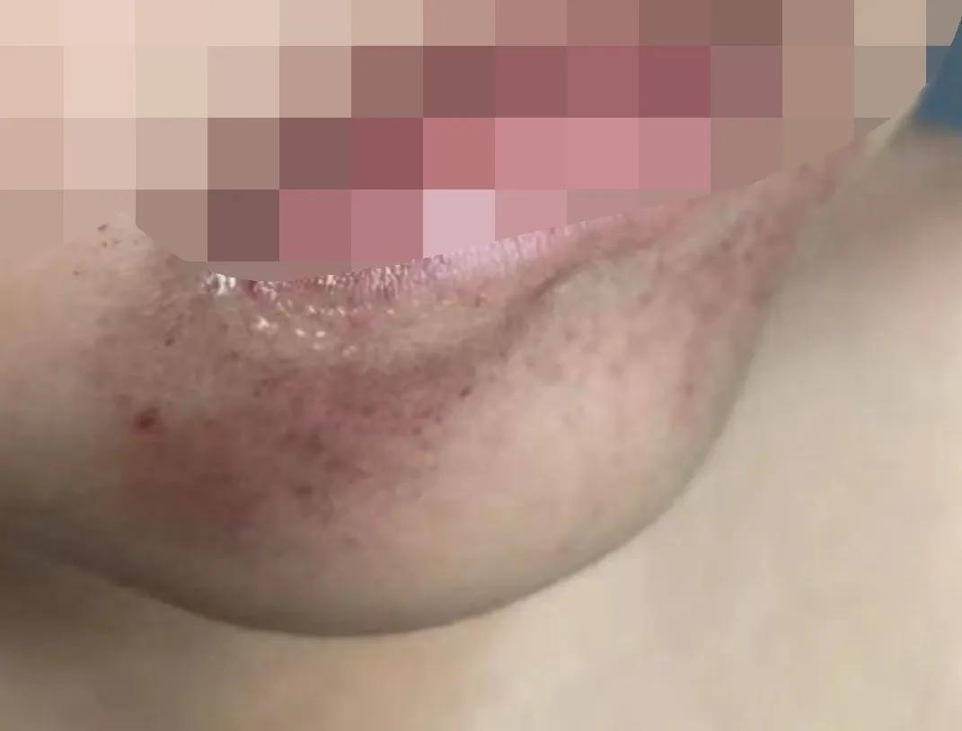 身上突然起小红点需要看医生吗,身上长了密密麻麻的小红点是什么