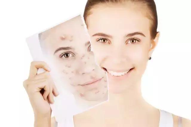 alinderose保加利亚玫瑰纯露,保湿祛皱淡斑抗老