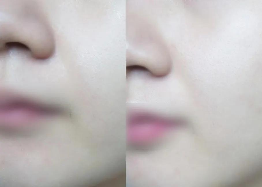 每天十分钟消除法令纹,填充鼻基底「内附矫正视频」