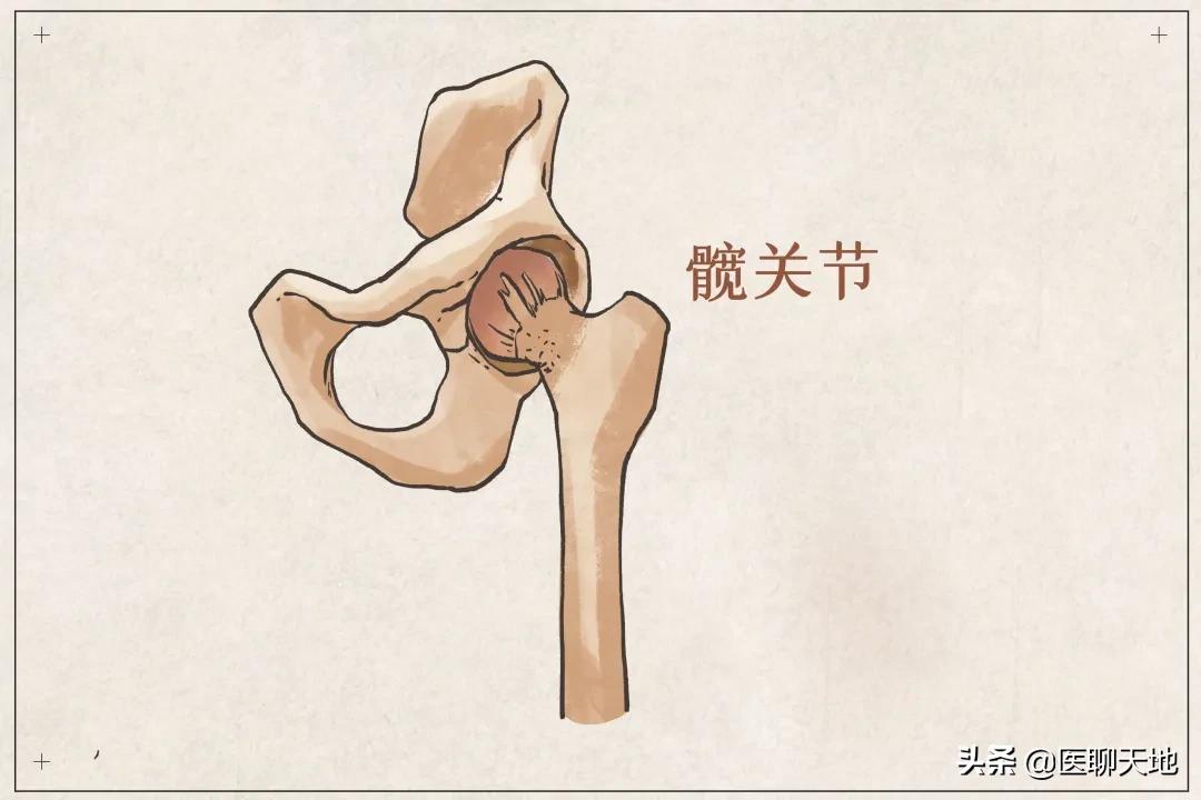 青医附院髋关节置换,髋关节置换亲身经历