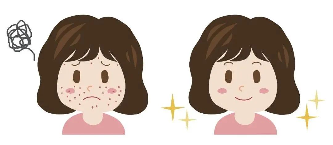 不同肌肤选择什么样子的洁面,如何选择一款合适的洁面产品