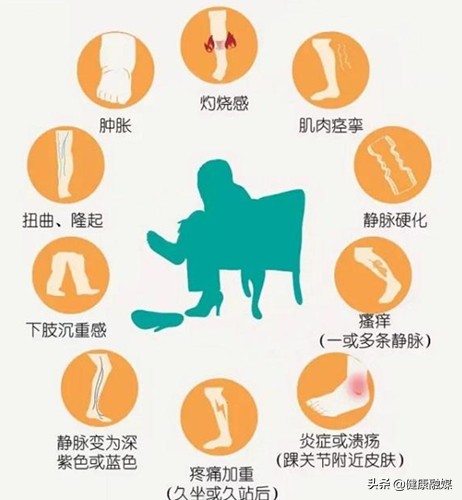 @下肢静脉曲张患者：静脉曲张难自愈，治疗迈入非手术时代