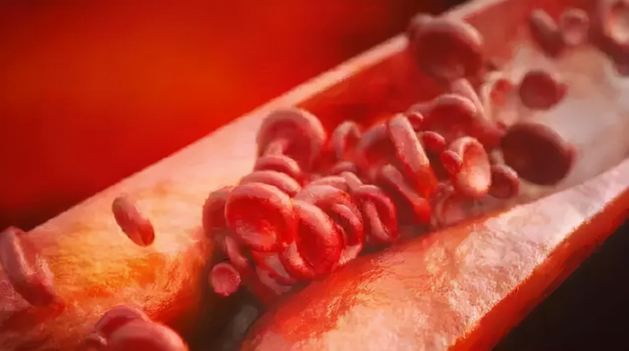 一个肠息肉切除干净后还会复发吗,肠息肉esd手术可以切除多大息肉