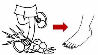 走路时总崴是什么原因,走路总是崴脚踝怎么回事