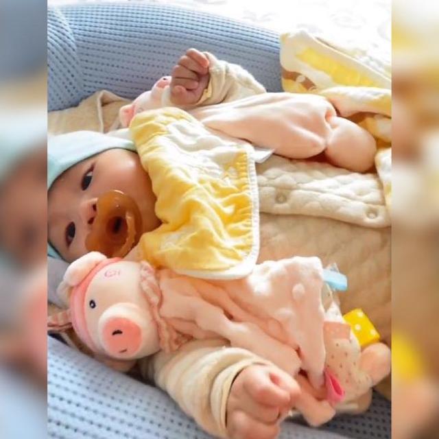 2个半月防止宝宝抓脸妙招,用什么方法可以有效阻止婴儿抓脸