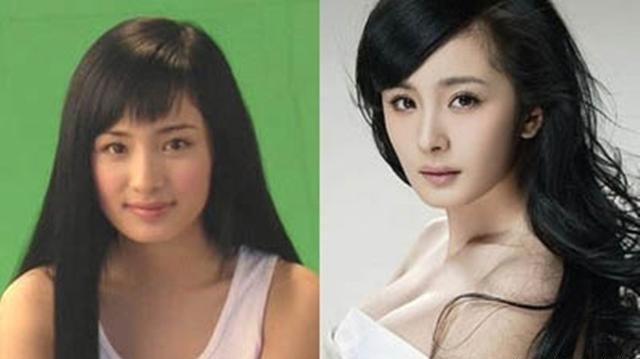 杨紫现身整形美容医院被嘲，牙齿矫形算不算整形？