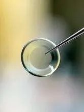 硬镜和软镜的区别,隐形眼镜硬镜和软镜区别