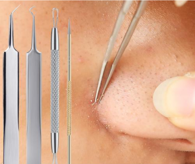 痘痘怎么挤才是正确的视频,痘痘怎么挤闭口