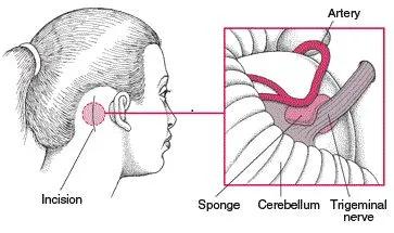 痛痛病疼痛特点,酸痛胀痛或刺痛有什么差别
