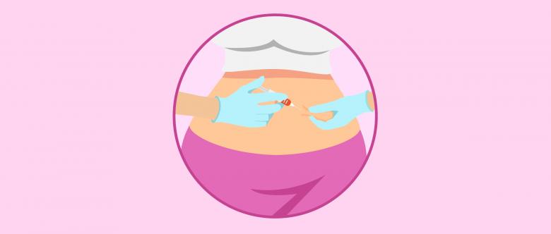 做试管婴儿一定要促排吗,不做试管可以做促排吗