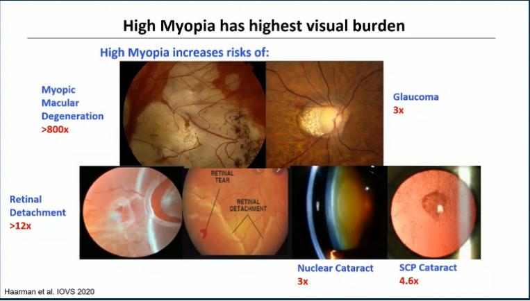 EURETINA热点丨全球策略：欧洲如何应对近视大流行？