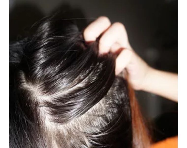 头发怎么洗都很油怎么办 (头发怎么洗都多油怎么办)