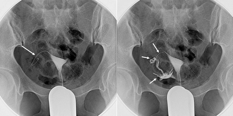 中国治疗不孕不育的送子观音,不孕不育求医之路