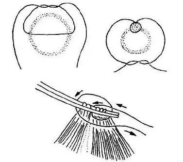 外科8种缝合方法图解,外科基本缝合方法实验报告
